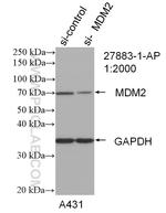 MDM2 Antibody in Western Blot (WB)