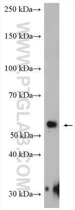 NAP1L4 Antibody in Western Blot (WB)