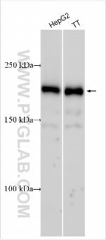 UBE2J1 Antibody in Western Blot (WB)