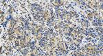 LACC1 Antibody in Immunohistochemistry (Paraffin) (IHC (P))