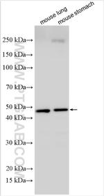 LACC1 Antibody in Western Blot (WB)