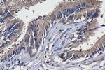 MERTK Antibody in Immunohistochemistry (Paraffin) (IHC (P))