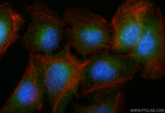 SH3TC2 Antibody in Immunocytochemistry (ICC/IF)