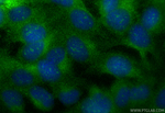 SH3TC2 Antibody in Immunocytochemistry (ICC/IF)