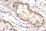 SH3TC2 Antibody in Immunohistochemistry (Paraffin) (IHC (P))