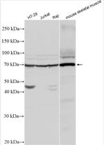 IL-13Ra1 Antibody in Western Blot (WB)