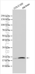 Maturin Antibody in Western Blot (WB)