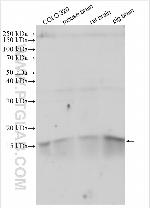 Maturin Antibody in Western Blot (WB)