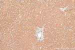 PTPRD Antibody in Immunohistochemistry (Paraffin) (IHC (P))