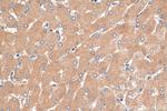 PTPRD Antibody in Immunohistochemistry (Paraffin) (IHC (P))