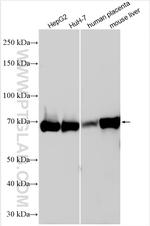 PTPRD Antibody in Western Blot (WB)