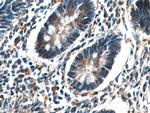 EIF2AK4 Antibody in Immunohistochemistry (Paraffin) (IHC (P))