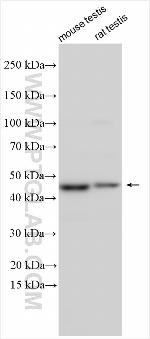 EIF2AK4 Antibody in Western Blot (WB)