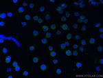 CD19 Antibody in Immunocytochemistry (ICC/IF)