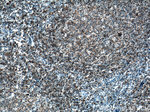 CD19 Antibody in Immunohistochemistry (Paraffin) (IHC (P))