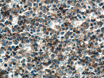 CD19 Antibody in Immunohistochemistry (Paraffin) (IHC (P))
