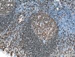 CD19 Antibody in Immunohistochemistry (Paraffin) (IHC (P))