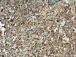 Cathepsin L Antibody in Immunohistochemistry (Paraffin) (IHC (P))
