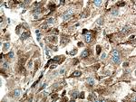 Cathepsin L Antibody in Immunohistochemistry (Paraffin) (IHC (P))
