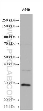 Cathepsin L Antibody in Western Blot (WB)