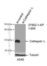 Cathepsin L Antibody in Western Blot (WB)