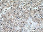 VE-cadherin Antibody in Immunohistochemistry (Paraffin) (IHC (P))