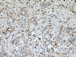 VE-cadherin Antibody in Immunohistochemistry (Paraffin) (IHC (P))