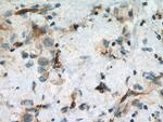 VE-cadherin Antibody in Immunohistochemistry (Paraffin) (IHC (P))
