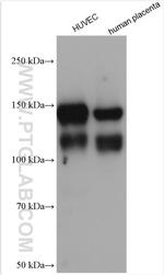 VE-cadherin Antibody in Western Blot (WB)