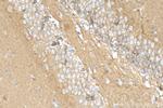 PHF24 Antibody in Immunohistochemistry (Paraffin) (IHC (P))