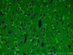 PHF24 Antibody in Immunohistochemistry (PFA fixed) (IHC (PFA))