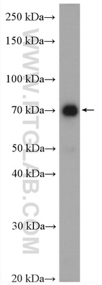 CXXC1 Antibody in Western Blot (WB)
