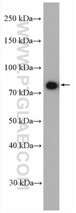 CXXC1 Antibody in Western Blot (WB)