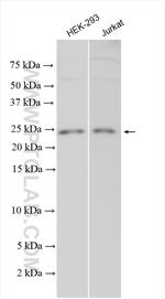 DHFRL1 Antibody in Western Blot (WB)