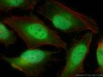 CAMKMT Antibody in Immunocytochemistry (ICC/IF)