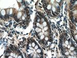 NOSIP Antibody in Immunohistochemistry (Paraffin) (IHC (P))