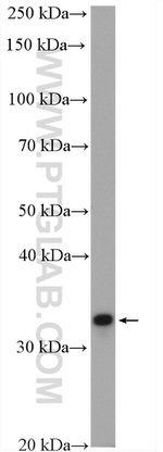 NOSIP Antibody in Western Blot (WB)