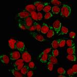 GnRH-Receptor/LH-RH Receptor Monoclonal Antibody (GNRHR/768)