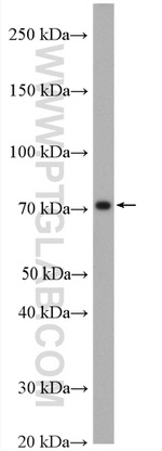 ABLIM3 Antibody in Western Blot (WB)