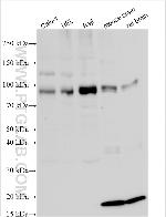 RBMXL2 Antibody in Western Blot (WB)