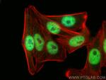 TOX4 Antibody in Immunocytochemistry (ICC/IF)