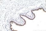 TOX4 Antibody in Immunohistochemistry (Paraffin) (IHC (P))