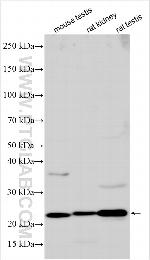 KCNQ5 Antibody in Western Blot (WB)
