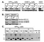 HPV Type 16 E7 Antibody in Western Blot (WB)