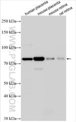 ARMC9 Antibody in Western Blot (WB)