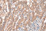 TUBG2 Antibody in Immunohistochemistry (Paraffin) (IHC (P))