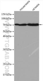 SPESP1 Antibody in Western Blot (WB)