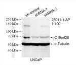 C19orf26 Antibody in Western Blot (WB)