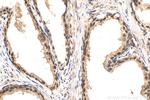 ZFPM1 Antibody in Immunohistochemistry (Paraffin) (IHC (P))