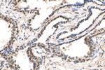 ZFPM1 Antibody in Immunohistochemistry (Paraffin) (IHC (P))